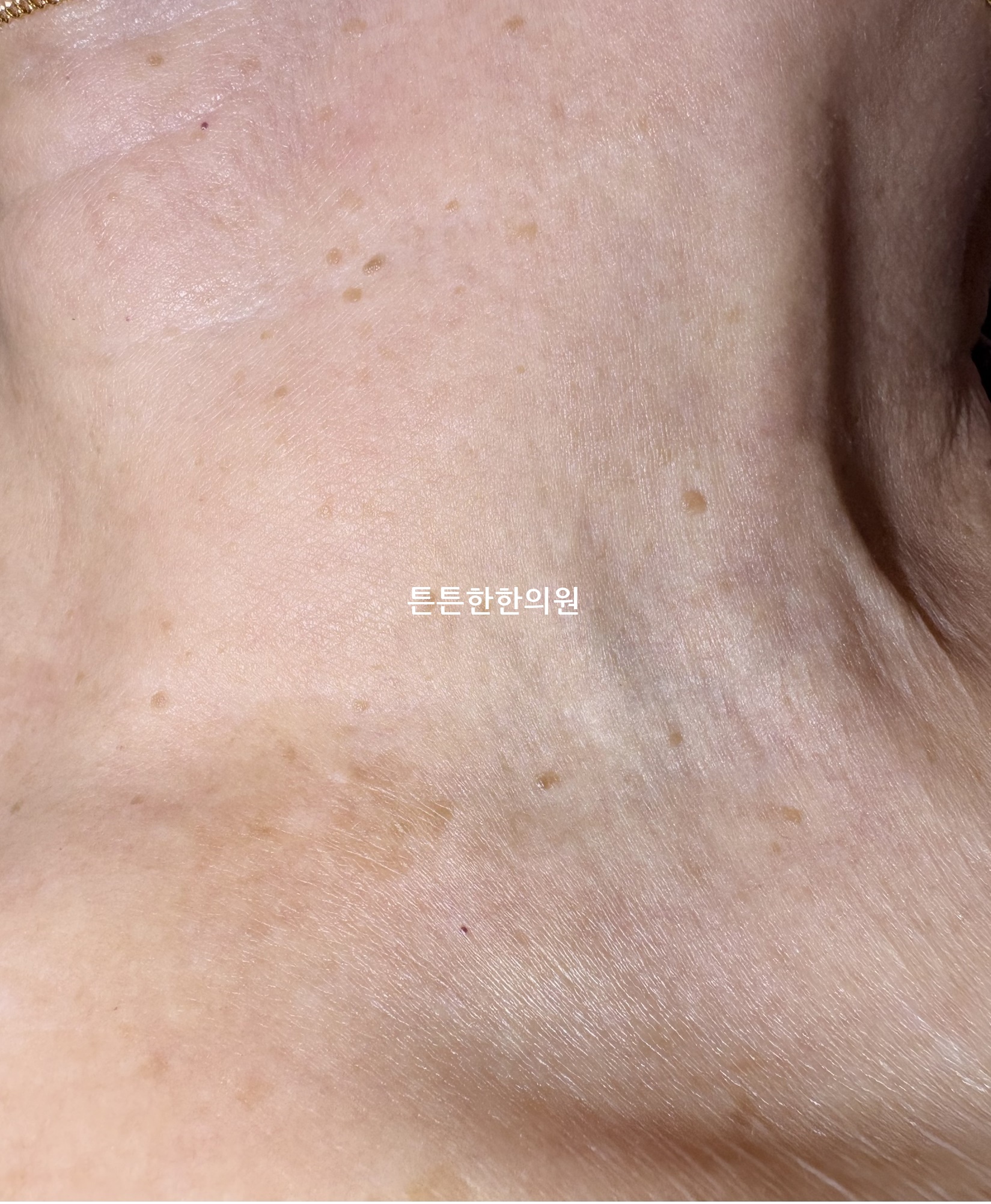 대구편평사마귀성지