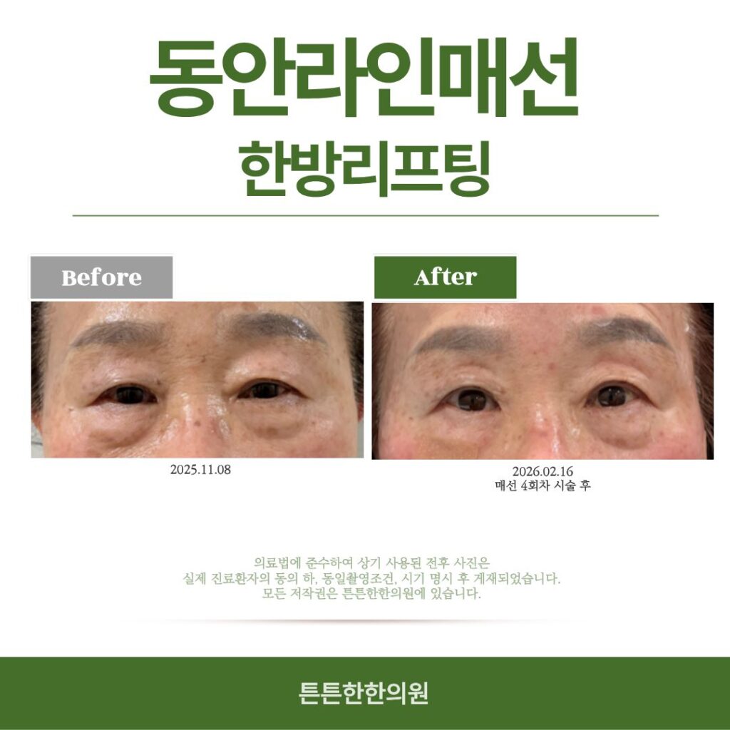 대구매선잘하는곳